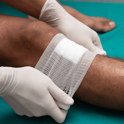 VENOUS LEG ULCER TREATMENT